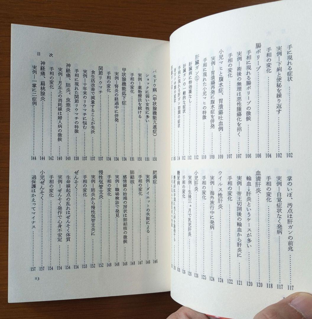 手相で病気を早期発見―患者の手形で実証した