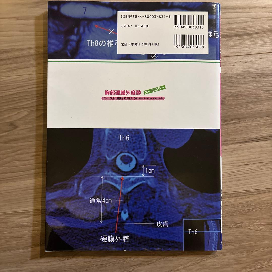 胸部硬膜外麻酔 MLA