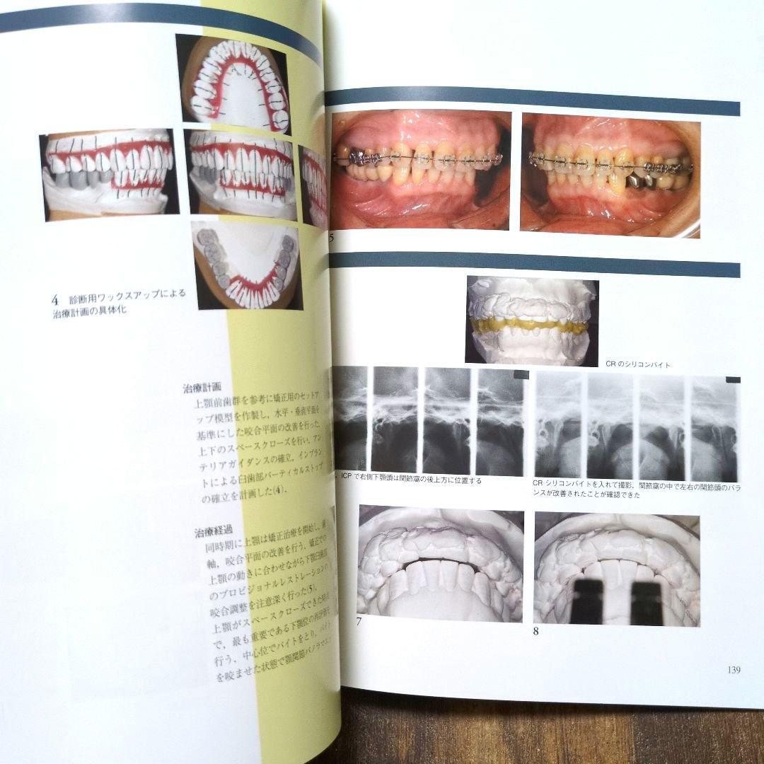 インプラントレストレーション vol. III